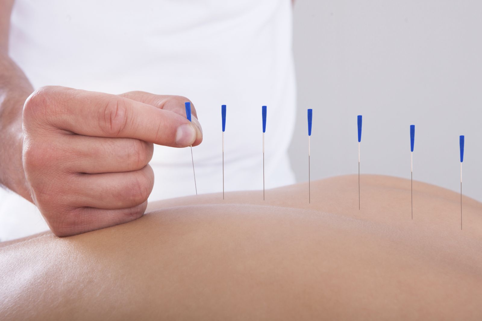 Acupuncture for Drug & Alcohol Rehab